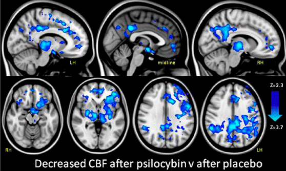 psilocybin-brain1